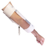 Cubitus Fossa Elbow Splint