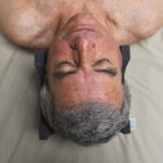 Neurological Head Holder