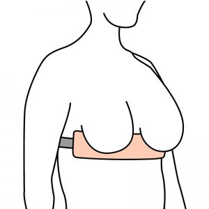 Breast Separator