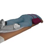 ERCP Positioning Wedge & Straps