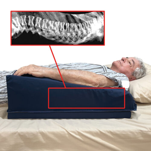 Arm Elevator Pad 3340