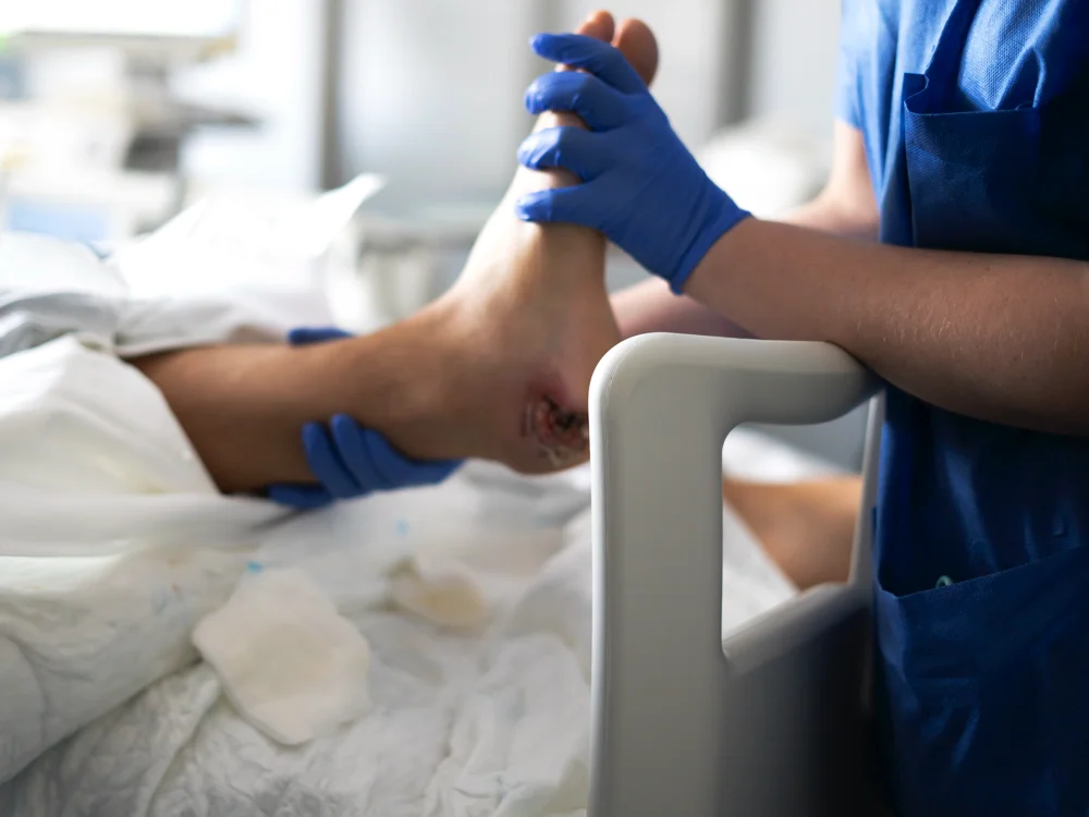 Pressure Care Equipment